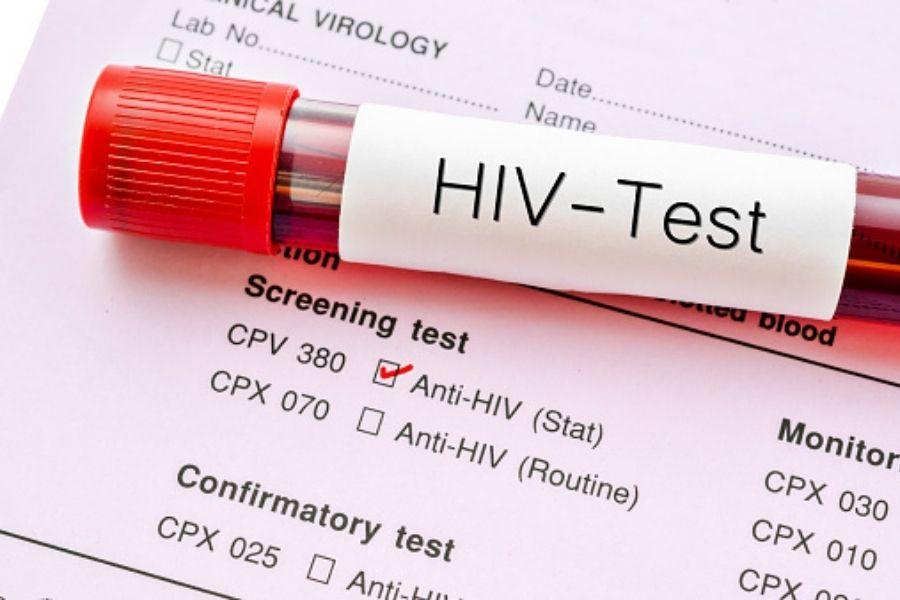 Casos de HIV na Baixada Santista diminuem quase 30% em um ano