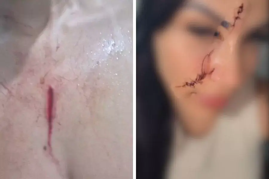 Cabeleireira leva golpes de punhal após tentar resolver conflito entre filhos e colega em Praia Grande