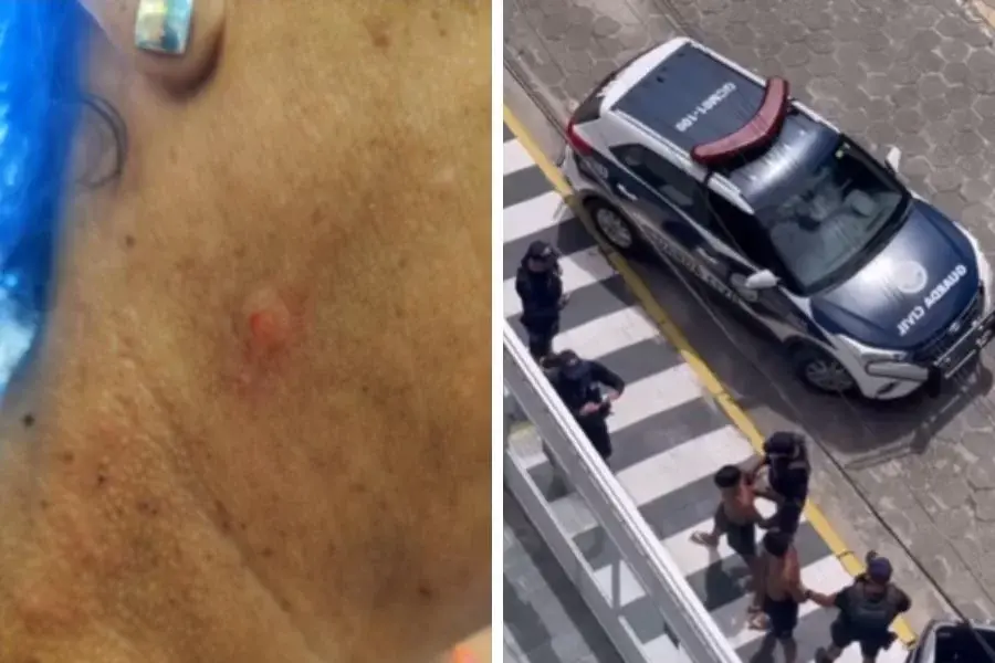 Turista idosa é agredida durante roubo de correntinha em Guarujá