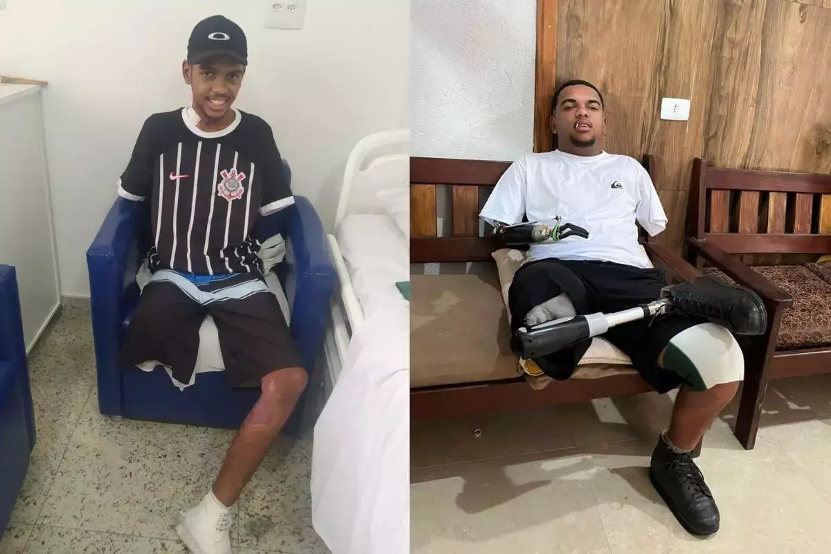 A luta do jovem que perdeu braços e perna após descarga elétrica no litoral de São Paulo; veja como ajudar