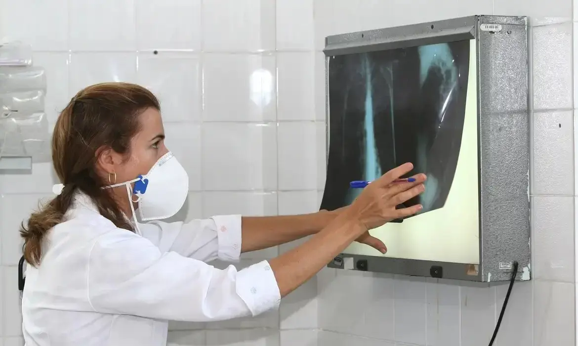 Campanha contra a tuberculose será permanente em Santos