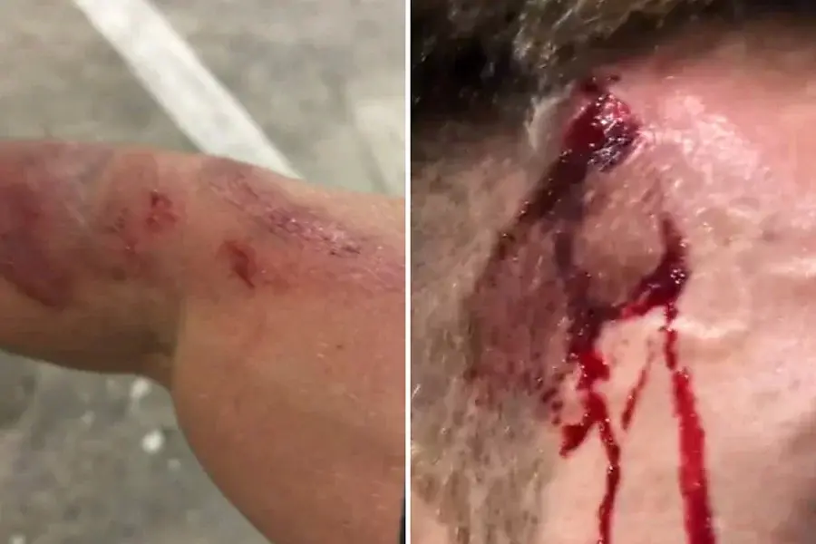 Guarda-vidas fica ferido após tentar fugir de assalto em Guarujá
