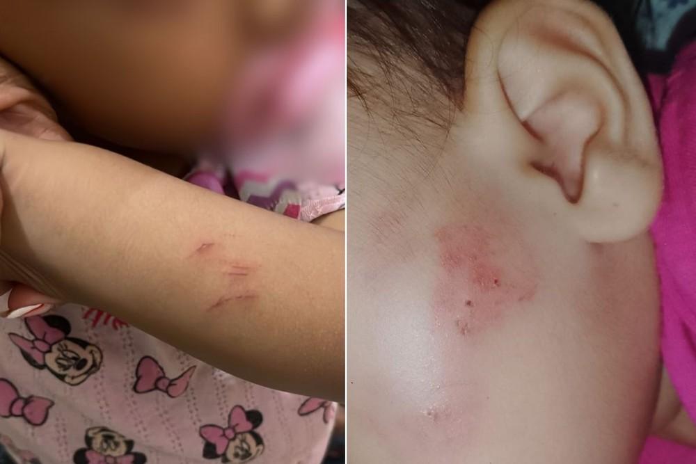 Outras duas bebês de um ano também voltaram da creche com hematomas. — Foto: Arquivo Pessoal