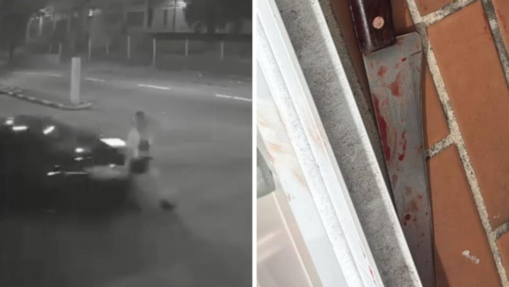 Mulher esfaqueada pelo marido em Santos já havia sido atropelada por ele