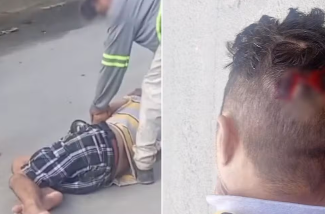 Homem cai em buraco de obra da Sabesp e sofre corte na cabeça no litoral de SP