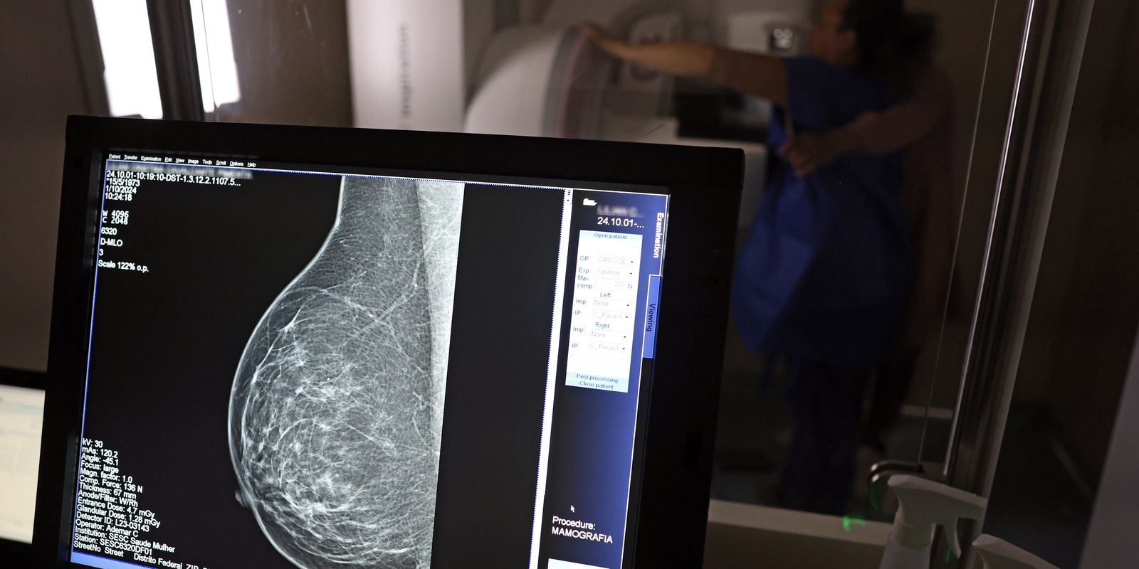 Médicos orientam como solicitar mamografia digital e evitar negativas de planos