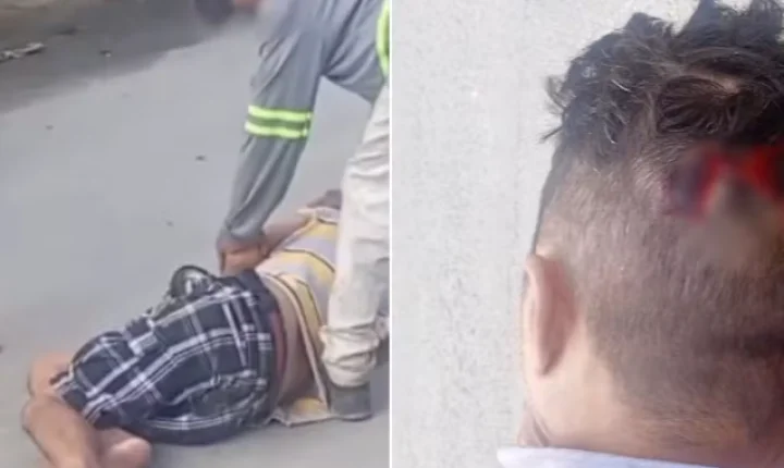Homem cai em buraco de obra da Sabesp e sofre corte na cabeça no litoral de SP