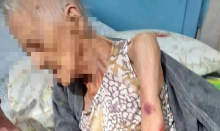Idosa de 94 anos morre e família denuncia possíveis maus-tratos de clínica em PG