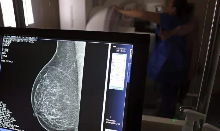 Médicos orientam como solicitar mamografia digital e evitar negativas de planos